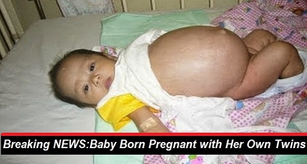 Pregnant Baby Born 59