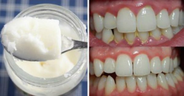 Remove Plaque, Mouth Bacteria and Bad Breath, Strengthen Your Gums and Whiten Yo