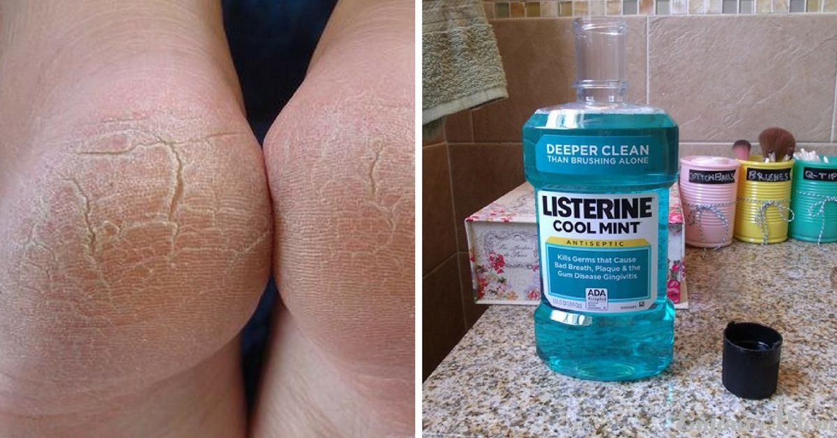 10-amazing-uses-for-listerine-that-every-woman-should-know