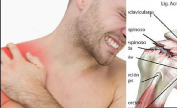 DO YOU HAVE PAIN IN YOUR SHOULDER? IT’S CALLING TENDINITIS AND WE GIVE YOU TIPS TO RELIEVE IT