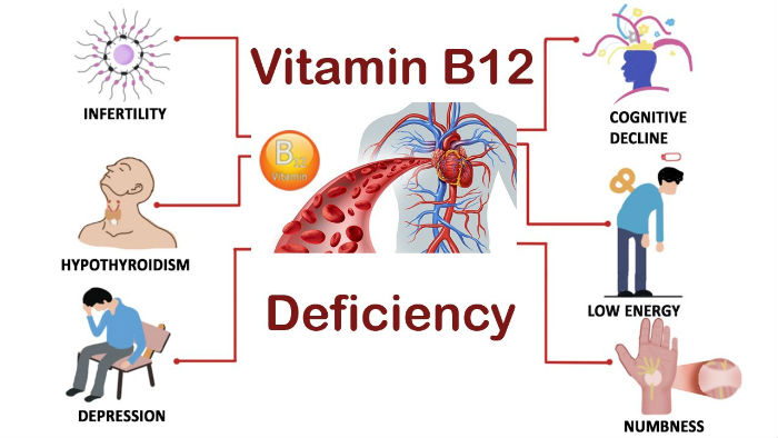 Image result for vitamin b12 deficiency