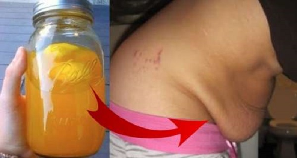 Goodbye To The Fallen Belly! You Can Eliminate It With This Powerful Natural Remedy In Just 10 Days