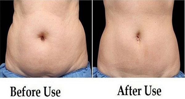 Drink-This-Beverage-Every-Morning-on-an-Empty-Stomach-and-Say-Goodbye-to-Belly-Fat-2