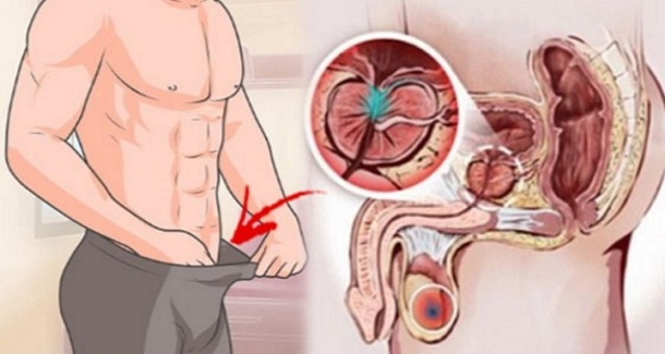 Warning Signs Of Prostate Cancer