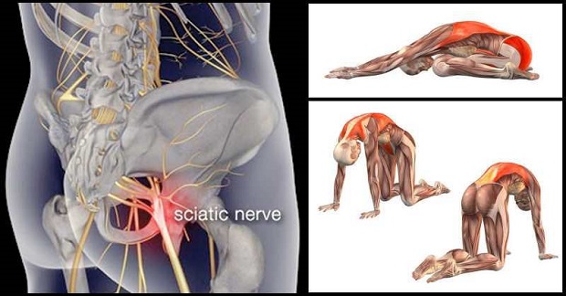 8 Exercises for Sciatica and Lower Back Pain Relieve